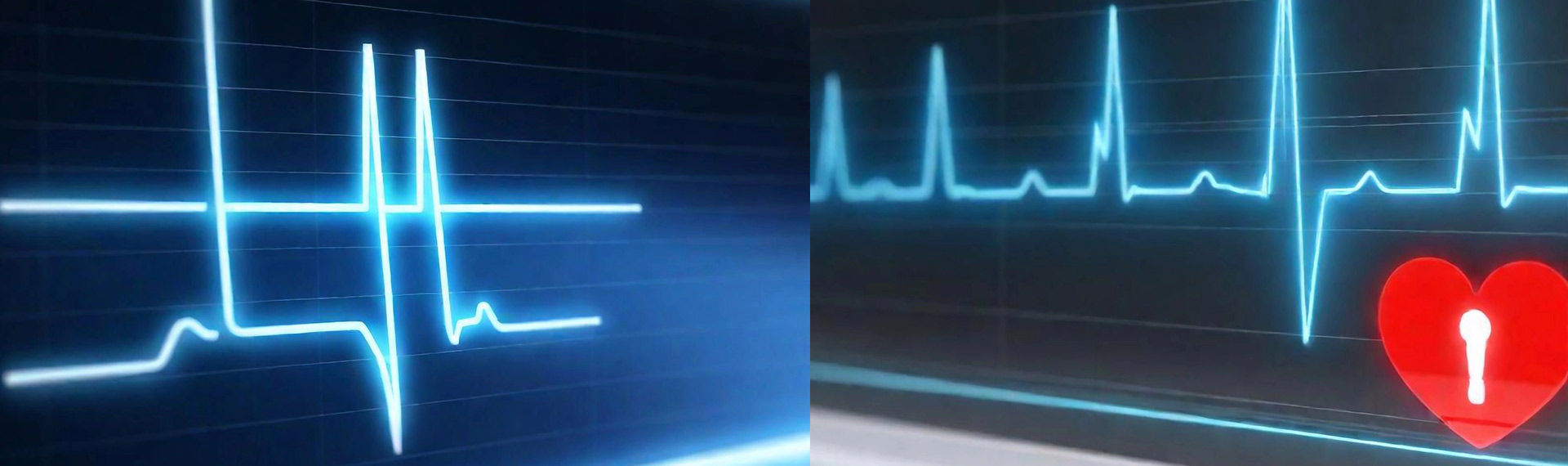 Waveforms for EKG test in Nanuet, NY