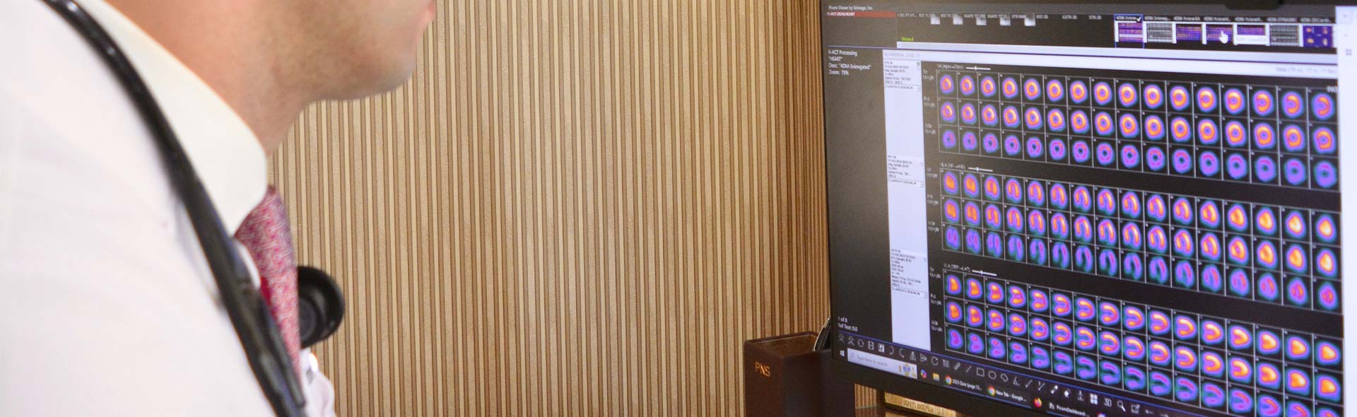 Heart Attack Dr. looking at images on computer in Nanuet, NY