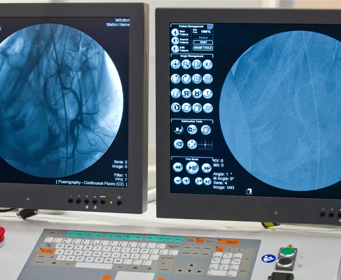 Coronary Angiogram on Monitors in a Tappan, NY doctor's office