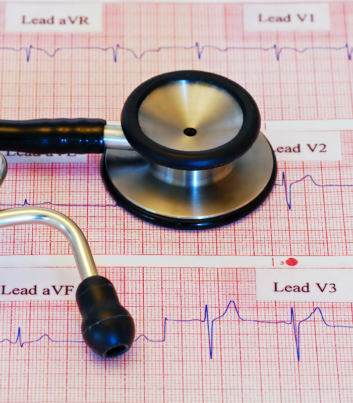 Results of Heart Testing Via an ECG/EKG Cardiac Stress Test for Monsey, NY Patient