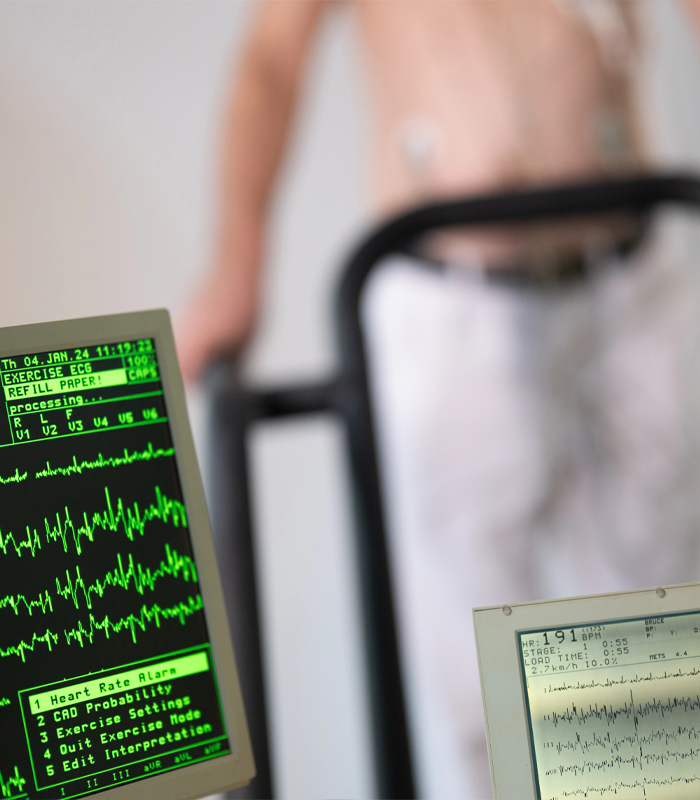 Bardonia, NY Patient Taking Cardiac Stress Test on Treadmill